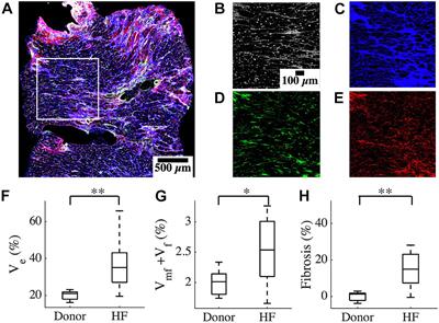 Etiology-Specific Remodeling in Ventricular Tissue of Heart Failure Patients and Its Implications for Computational Modeling of Electrical Conduction